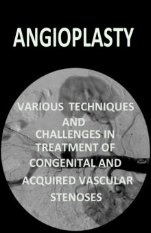 Angioplasty, Various Techniques and Challenges in Treatment of Congenital and  Acquired Vascular Stenoses