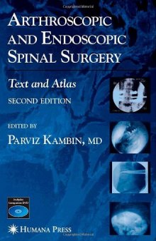Arthroscopic and endoscopic spinal surgery: text and atlas