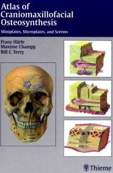 Atlas of Craniomaxillofacial Osteosynthesis: Micro-miniplates and Screws