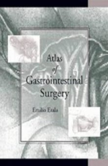 Atlas of Gastrointestinal Surgery (Two-Volume Set) (Books)
