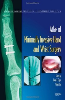 atlas of minimal invasive hand and wrist surgery