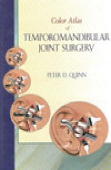 Color Atlas Of Temporomandibular Joint Surgery