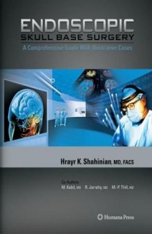 Endoscopic Skull Base Surgery: A Comprehensive Guide with Illustrative Cases