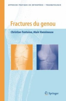 Fractures du genou (Approche pratique en orthopedie-traumatologie)