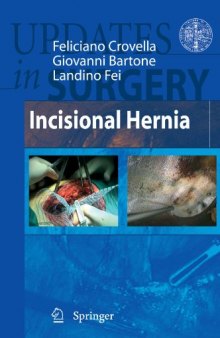 Incisional Hernia (Updates in Surgery)