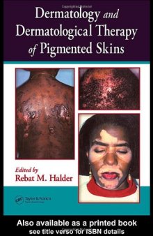 Dermatology and Dermatological Therapy of Pigmented Skins