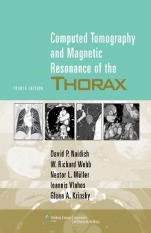 Computed Tomography and Magnetic Resonance of the Thorax 4th Edition