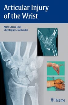 Articular Injury of the Wrist: FESSH 2014 Instructional Course Book
