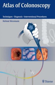 Atlas of Colonoscopy: Examination Techniques and Diagnosis
