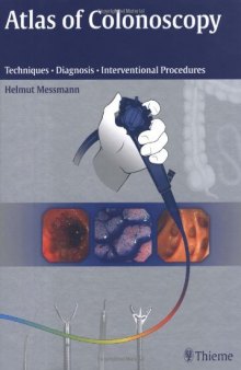 Atlas of Colonoscopy: Techniques · Diagnosis · Interventional Procedures