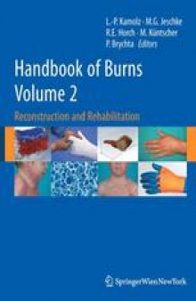 Handbook of Burns: Reconstruction and Rehabilitation Volume 2