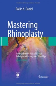 Mastering Rhinoplasty, Second Edition: A Comprehensive Atlas of Surgical Techniques