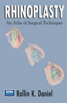 Rhinoplasty: An Atlas of Surgical Techniques
