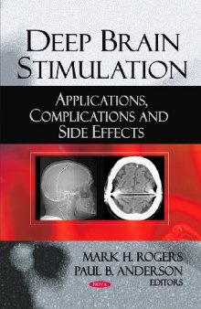 Deep Brain Stimulation: Applications, Complications and Side Effects