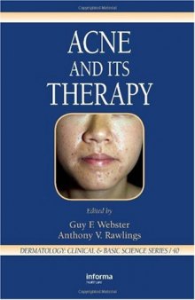Acne and its therapy