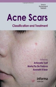 Acne Scars: Classification and Treatment (Series in Dermatological Treatment)