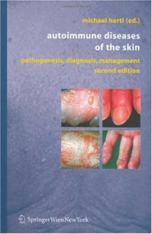 Autoimmune Diseases of the Skin Pathogenesis, Diagnosis, Management