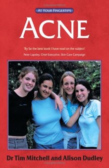 Acne: The 'At Your Fingertips' Guide (At Your Fingertips)