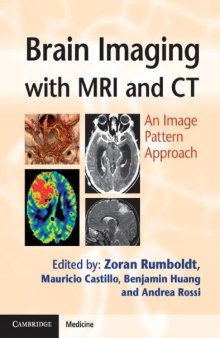 Brain Imaging with MRI and CT: An Image Pattern Approach