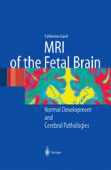 MRI of the Fetal Brain: Normal Development and Cerebral Pathologies