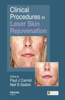 Clinical Procedures in Laser Skin Rejuvenation (Series in Cosmetic and Laser Therapy)