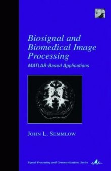 Biosignal and Medical Image Processing: MATLAB-Based Applications (Signal Processing and Communications)  