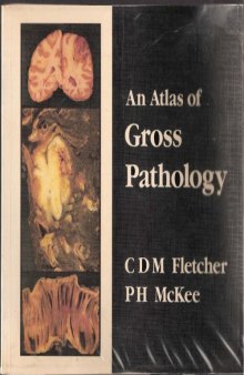 An Atlas of Gross Pathology