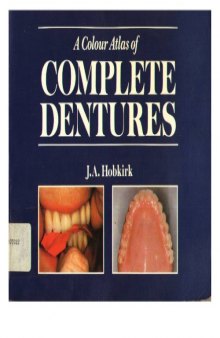 A colour atlas of complete dentures