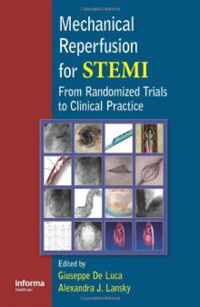 Mechanical Reperfusion for STEMI: From Randomized Trials to Clinical Practice