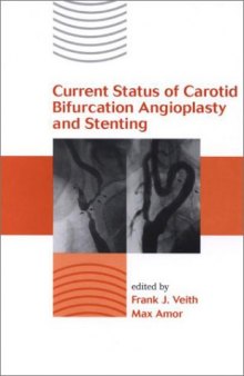 Current Status of Carotid Bifurcation Angioplasty and Stenting