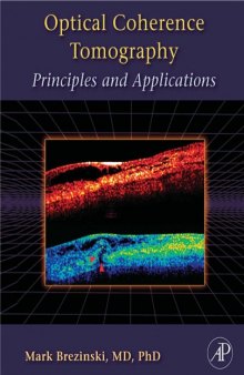 Optical coherence tomography : principles and applications