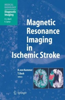 Book MRI in Ischemic Stroke