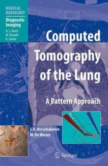 Computed Tomography of the Lung A Pattern Approach