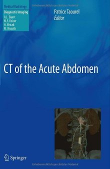 CT of the Acute Abdomen 
