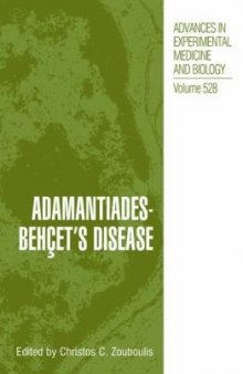Adamantiades-Behçet’s Disease