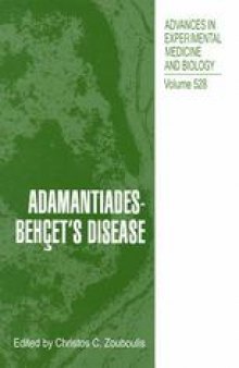 Adamantiades-Behçet’s Disease