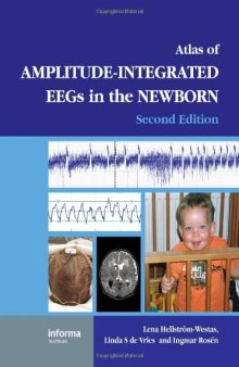 An Atlas of Amplitude-Integrated EEGs in the Newborn (2nd Edition) (Encyclopedia of Visual Medicine Series)