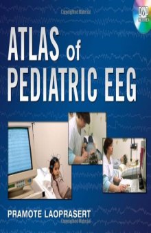 Atlas of Pediatric EEG (Atlas Series)  