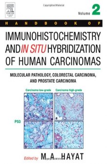 Handbook of Immunohistochemistry and in Situ Hybridization of Human Carcinomas, Volume 2: Molecular Pathology, Colorectal Carcinoma, and Prostate Carcinoma