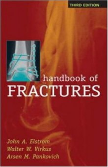 Handbook of Fractures, 3rd Edition  