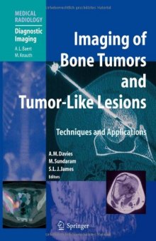 Imaging of Bone Tumors and Tumor-Like Lesions: Techniques and Applications