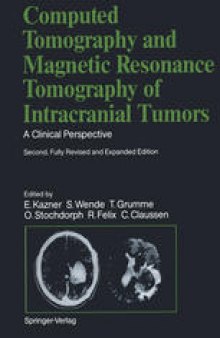Computed Tomography and Magnetic Resonance Tomography of Intracranial Tumors: A Clinical Perspective