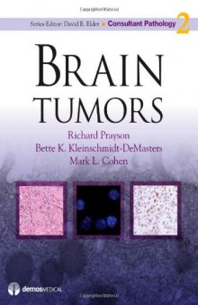 Brain Tumors (Consultant Pathology)