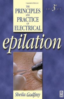 The principles and practice of electrical epilation