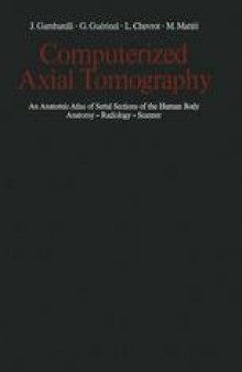 Camputerized Axial Tomography: An Anatomic Atlas of Serial Sections of the Human Body Anatomy — Radiology — Scanner