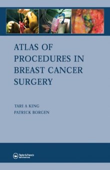 Atlas of Procedures in Breast Cancer Surgery