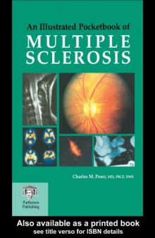 An illustrated pocketbook of multiple sclerosis