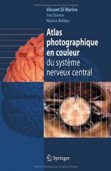 Atlas photographique en couleur du systeme nerveux central (French Edition)