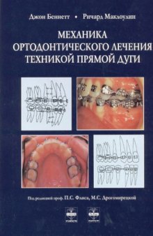 Механика ортодонтического лечения техникой прямой дуги