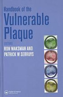 Handbook of the vulnerable plaque